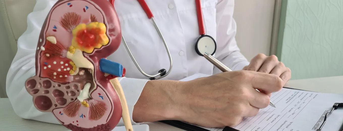 Nephrectomy