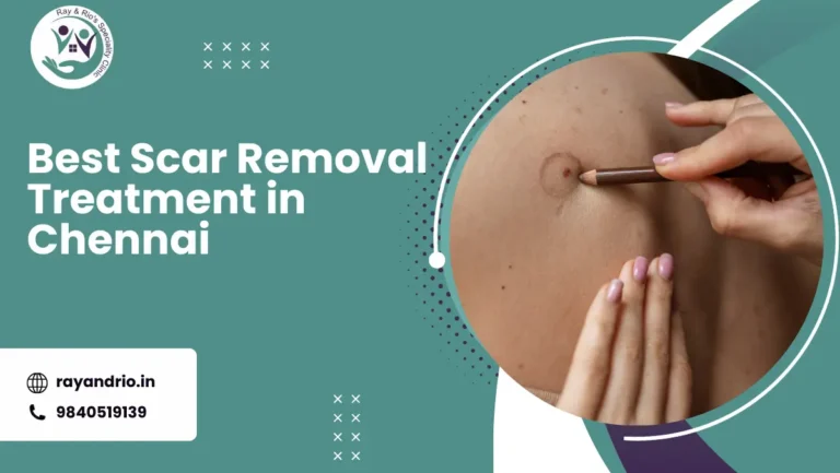 Best Scar Removal Treatment in Chennai