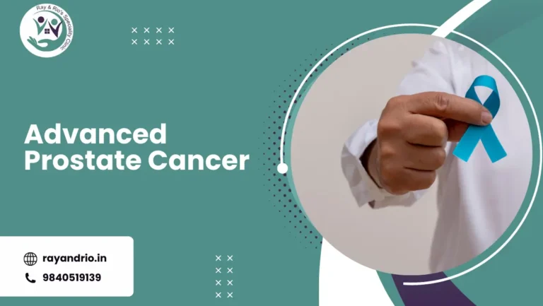 Advanced Prostate Cancer