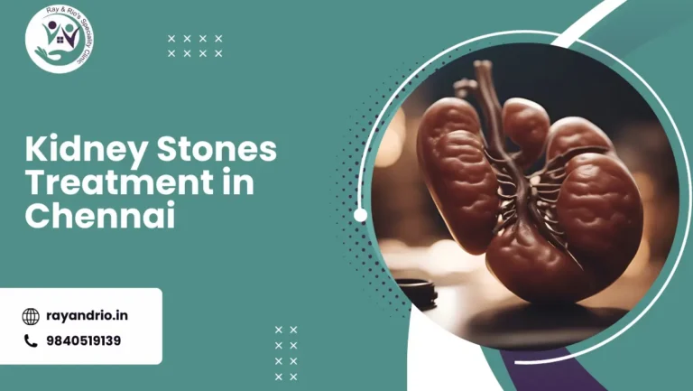 Kidney Stones Treatment in Chennai