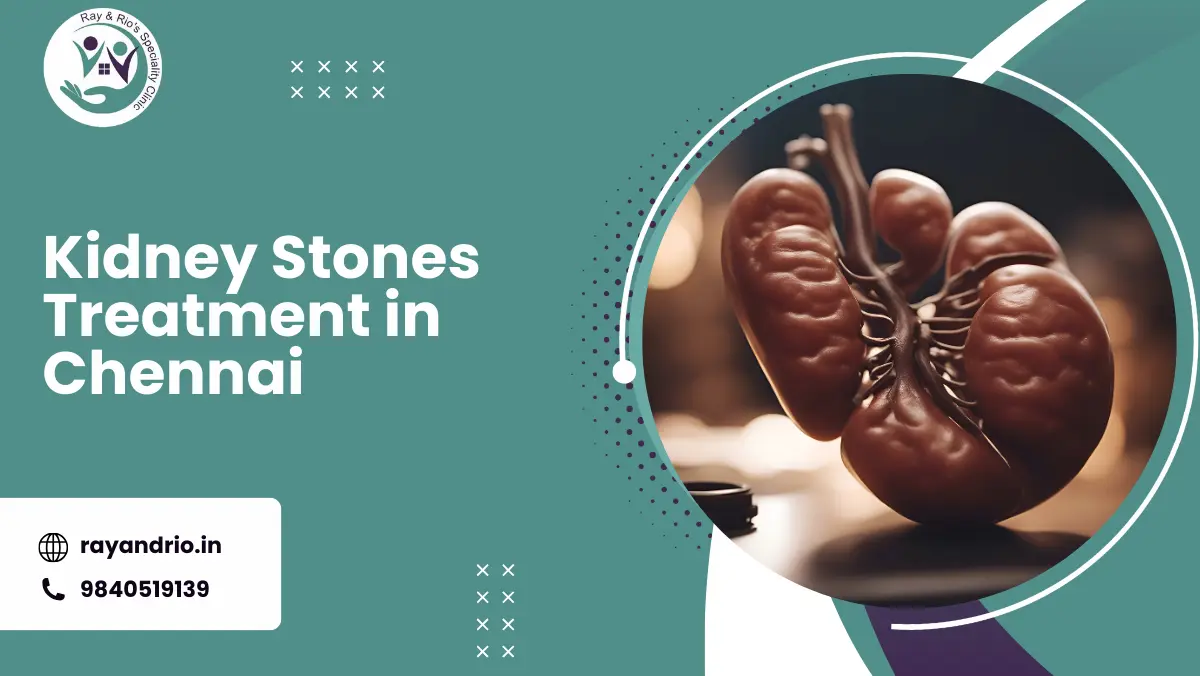 Kidney Stones Treatment in Chennai