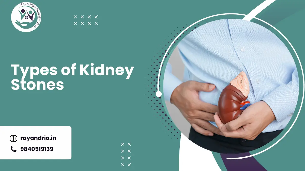 Types of Kidney Stones