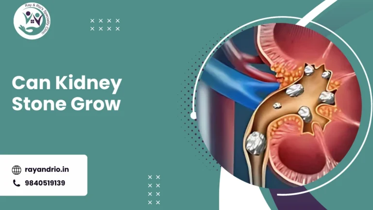 Can Kidney Stone Grow