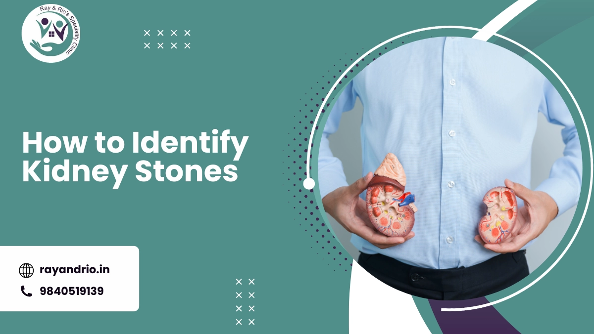 how to identify kidney stones