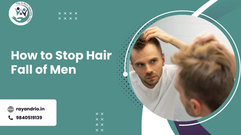 How to Stop Hair Fall of Men