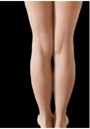Fat Reduction 8