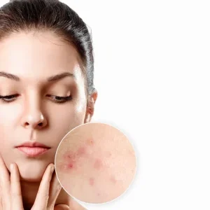 Best Skin Care Clinic in Chennai