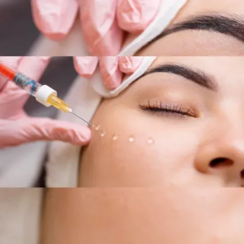 Botox
