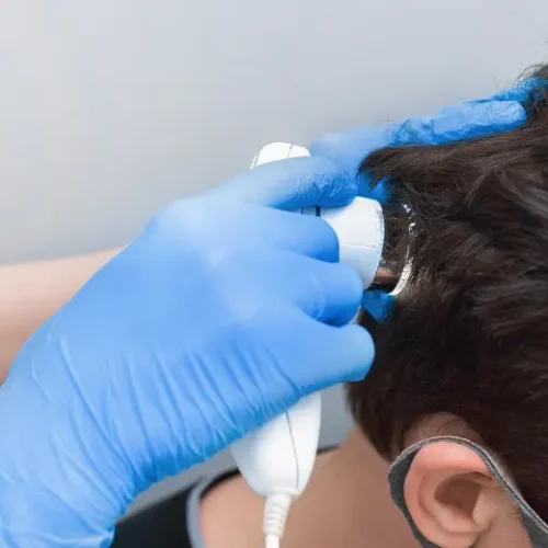 Hair Growth Treatments in Chennai