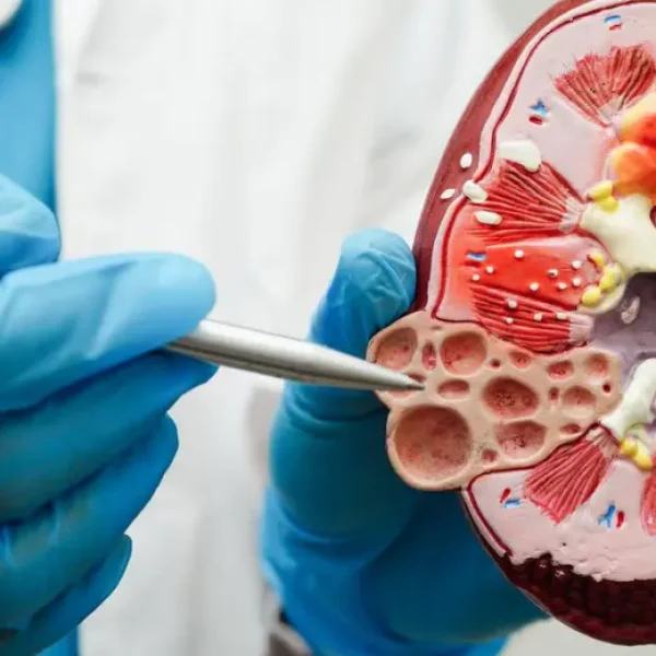 Kidney Transplant