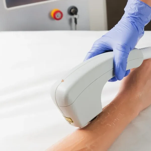 Laser Hair Removal