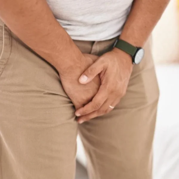 Varicocele